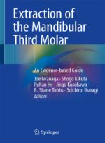 Extraction of the Mandibular Third Molar: An Evidence-based Guide 2025