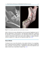 Extraction of the Mandibular Third Molar: An Evidence-based Guide 2025 - Image 4