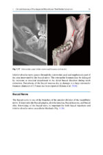 Extraction of the Mandibular Third Molar: An Evidence-based Guide 2025 - Image 4