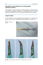 Extraction of the Mandibular Third Molar: An Evidence-based Guide 2025 - Image 7