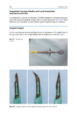 Extraction of the Mandibular Third Molar: An Evidence-based Guide 2025 - Image 7