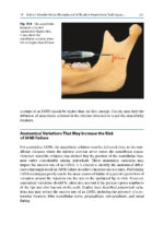 Extraction of the Mandibular Third Molar: An Evidence-based Guide 2025 - Image 8