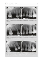 The Periodontic-Endodontic Interface 2024 - Image 4