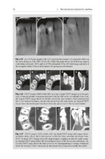 The Periodontic-Endodontic Interface 2024 - Image 5