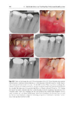The Periodontic-Endodontic Interface 2024 - Image 8
