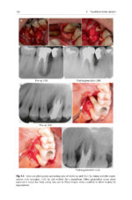 The Periodontic-Endodontic Interface 2024 - Image 2