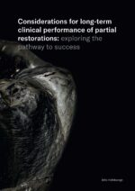 Considerations for long term clinical performance of partial restorations 2023