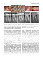 Minimally Invasive Approaches in Endodontic Practice 2021 - Image 3