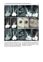 Minimally Invasive Approaches in Endodontic Practice 2021 - Image 4