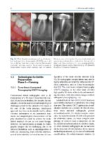 Minimally Invasive Approaches in Endodontic Practice 2021 - Image 5
