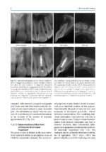 Minimally Invasive Approaches in Endodontic Practice 2021 - Image 7