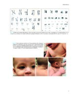 Oral and Maxillofacial Surgery in Children 2023 - Image 3