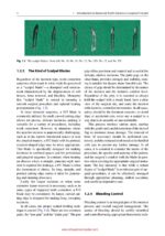 Advanced Strategies for Tooth Extraction in Dentistry 2024 - Image 15