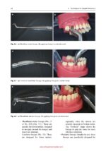 Advanced Strategies for Tooth Extraction in Dentistry 2024 - Image 17