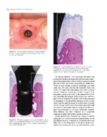 Saving Dental Implants 2024 - Image 3