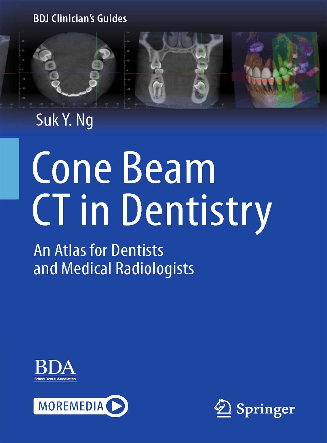 Cone-Beam-CT-in-Dentistry-2023 Cone Beam CT in Dentistry: An Atlas for Dentists and Medical Radiologists 2023 (BDJ Clinician’s Guides) - Image 1