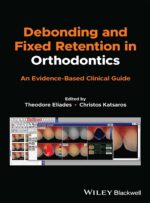 Debonding and Fixed Retention in Orthodontics: An Evidence-Based Clinical Guide 2024