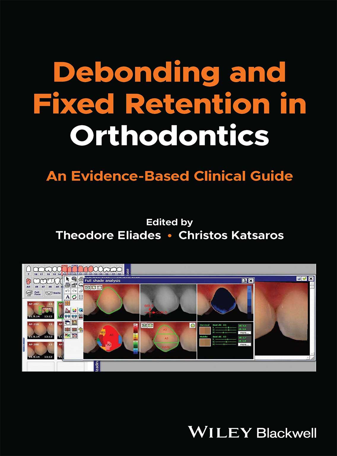 Debonding-and-Fixed-Retention-in-Orthodontics-2024f Debonding and Fixed Retention in Orthodontics: An Evidence-Based Clinical Guide 2024 - Image 1