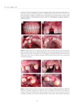 Dental Biomaterials From Fundamental Principles to Clinical Applications 2024 - Image 2