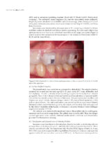 Dental Biomaterials From Fundamental Principles to Clinical Applications 2024 - Image 5