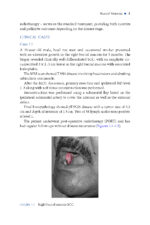 Local and Regional Flaps in Oral Cavity Cancer Reconstruction: A Case-Based Approach 2026 - Image 2
