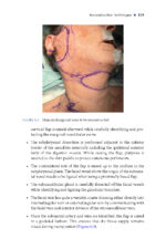 Local and Regional Flaps in Oral Cavity Cancer Reconstruction: A Case-Based Approach 2026 - Image 6
