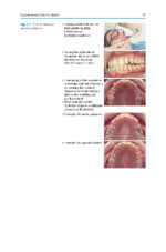 A Guide to Good Occlusal Practice 2022 (BDJ Clinician’s Guides) - Image 8