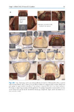 A Guide to Good Occlusal Practice 2022 (BDJ Clinician’s Guides) - Image 9