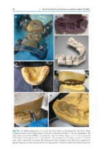 A Guide to Good Occlusal Practice 2022 (BDJ Clinician’s Guides) - Image 3