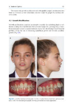 A Guide to Good Occlusal Practice 2022 (BDJ Clinician’s Guides) - Image 4