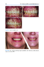 A Guide to Good Occlusal Practice 2022 (BDJ Clinician’s Guides) - Image 6