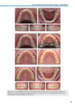 Orthodontic Aligner Treatment 2021 - Image 2
