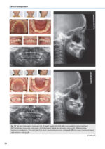 Orthodontic Aligner Treatment 2021 - Image 3