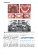 Orthodontic Aligner Treatment 2021 - Image 4