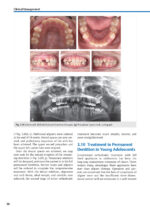 Orthodontic Aligner Treatment 2021 - Image 4