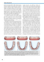 Orthodontic Aligner Treatment 2021 - Image 7