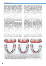 Orthodontic Aligner Treatment 2021 - Image 7