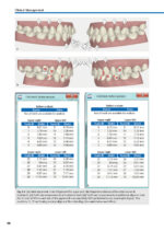 Orthodontic Aligner Treatment 2021 - Image 8