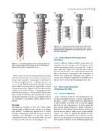 Clinical Insertion Techniques of Orthodontic Temporary Anchorage 2024 - Image 9