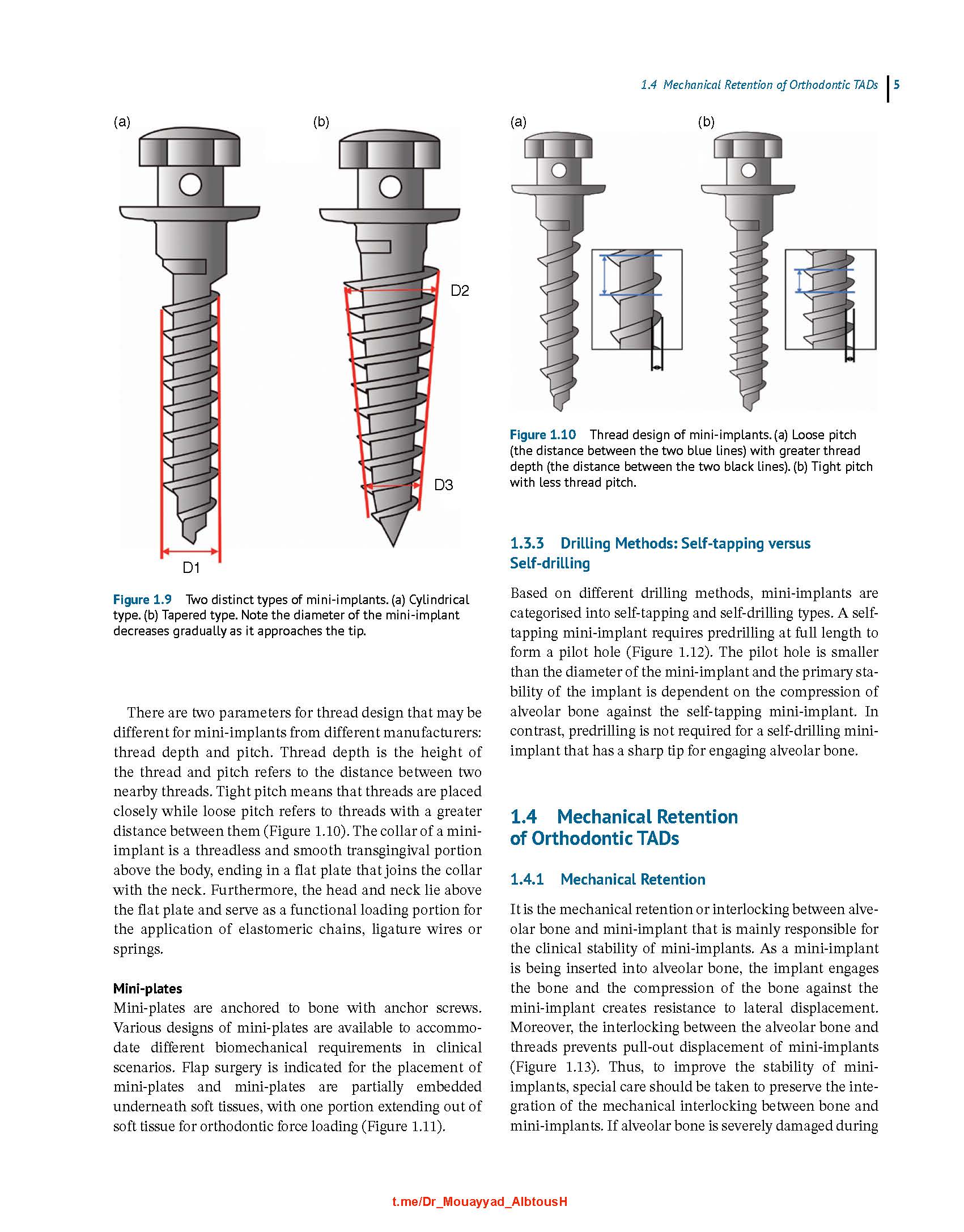 Clinical Insertion Techniques of Orthodontic Temporary Anchorage 2024 - Image 9