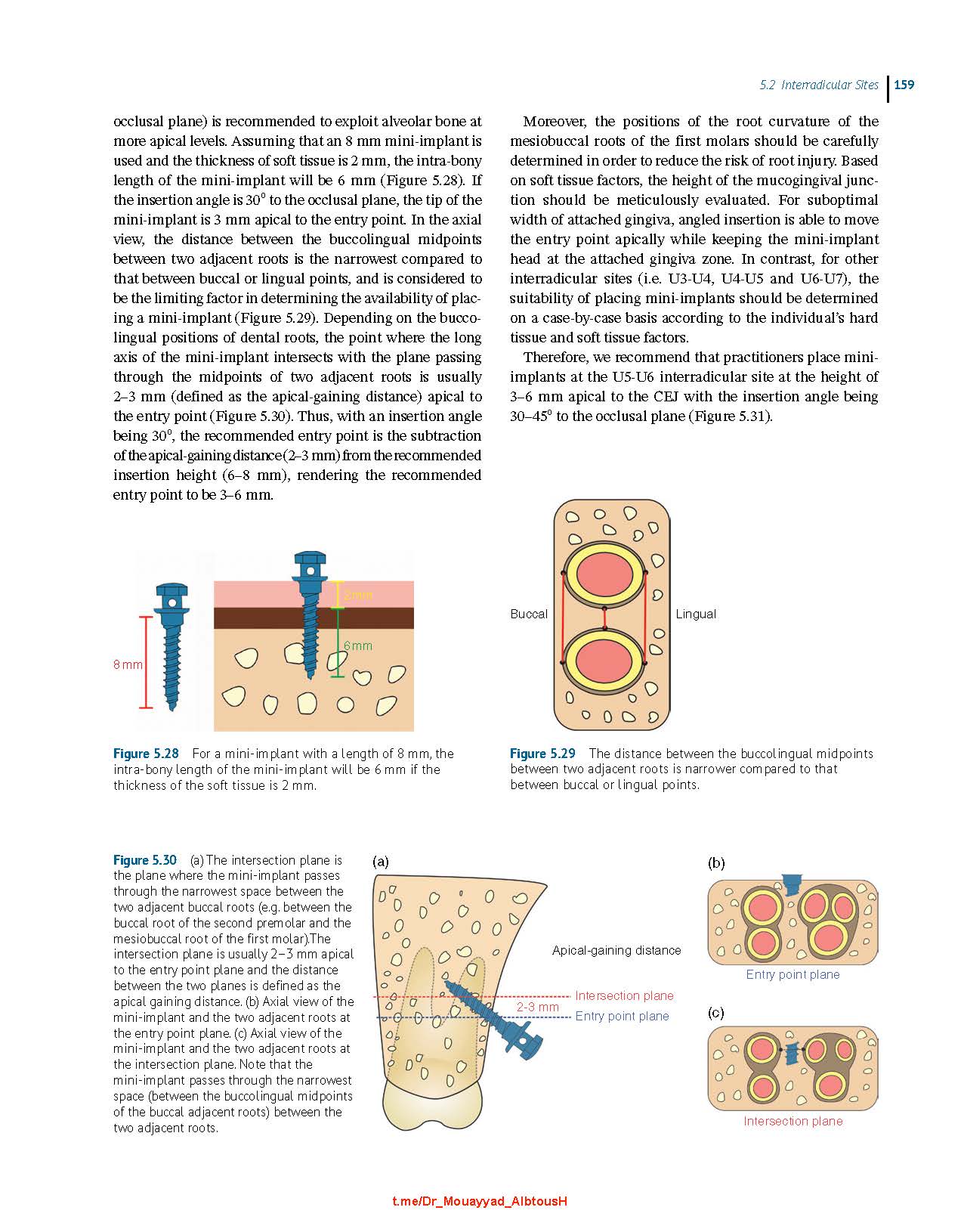 Clinical Insertion Techniques of Orthodontic Temporary Anchorage 2024 - Image 6