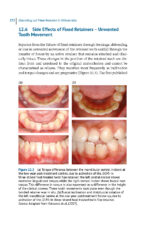 Debonding and Fixed Retention in Orthodontics: An Evidence-Based Clinical Guide 2024 - Image 3