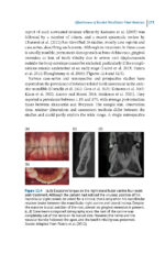 Debonding and Fixed Retention in Orthodontics: An Evidence-Based Clinical Guide 2024 - Image 4