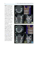 Cone Beam CT in Dentistry: An Atlas for Dentists and Medical Radiologists 2023 (BDJ Clinician’s Guides) - Image 8