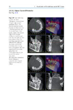 Cone Beam CT in Dentistry: An Atlas for Dentists and Medical Radiologists 2023 (BDJ Clinician’s Guides) - Image 9