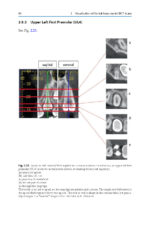 Cone Beam CT in Dentistry: An Atlas for Dentists and Medical Radiologists 2023 (BDJ Clinician’s Guides) - Image 2