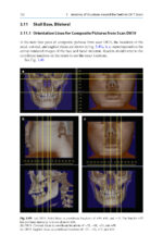 Cone Beam CT in Dentistry: An Atlas for Dentists and Medical Radiologists 2023 (BDJ Clinician’s Guides) - Image 3