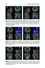Cone Beam CT in Dentistry: An Atlas for Dentists and Medical Radiologists 2023 (BDJ Clinician’s Guides) - Image 5