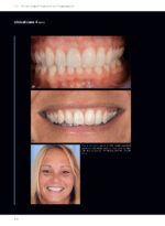 Soft Tissues & Pink Esthetics in Implant Therapy - Image 15
