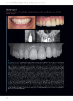 Soft Tissues & Pink Esthetics in Implant Therapy - Image 3